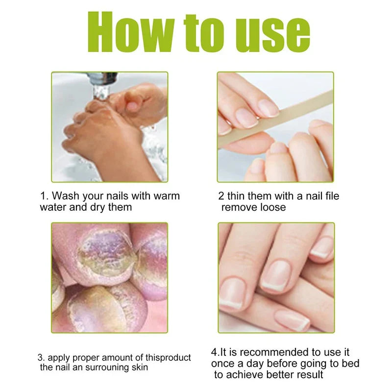 EELHOE – Nail Treatment Repair Gel